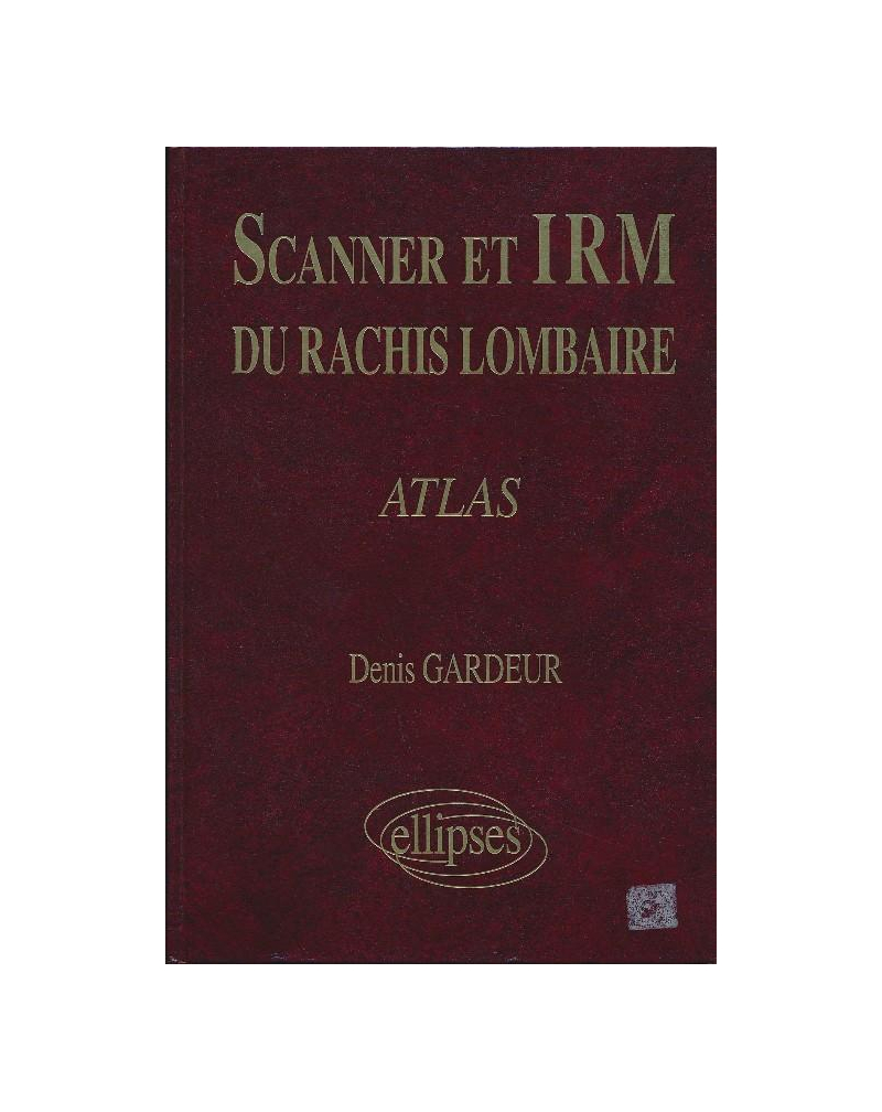 SCANNER IRM RACHIS LOMB.ATLAS