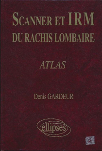 SCANNER IRM RACHIS LOMB.ATLAS